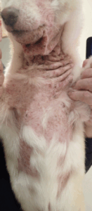 ニキビダニ症に伴う二次感染