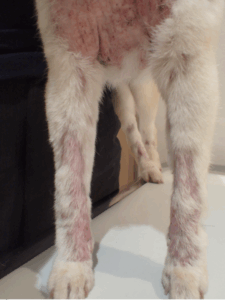 ニキビダニ症に伴う二次感染